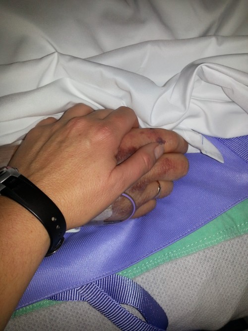 My father and I holding hands hours before he died with dignity.