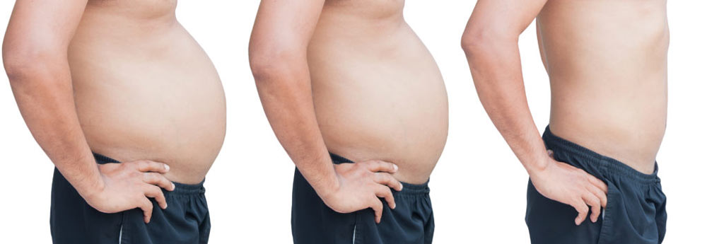 The 10 Worst Foods That You Should Avoid If You Plan For Weight Loss